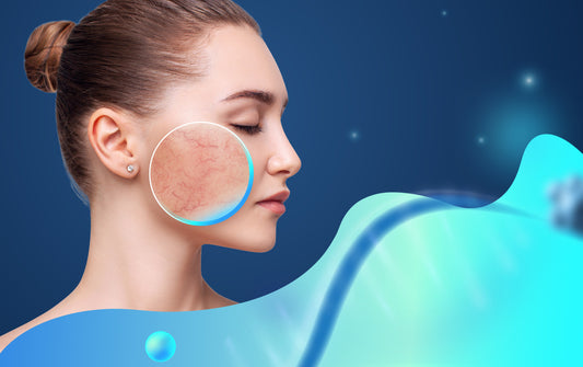 The Gut-Skin Axis: Is There A Connection Between SIBO and Rosacea?